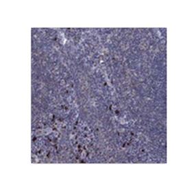 HPA064739-SAtlas Antibodies  Anti-PVR 25ul
