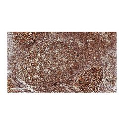 ZA-0542中杉金桥 PMS2抗体试剂（免疫组织化学）