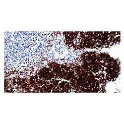 0.2ml中杉金桥 CD1a抗体试剂（免疫组织化学）
