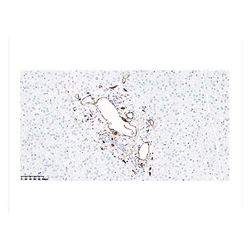 ZA-0550中杉金桥 CD34抗体试剂（免疫组织化学）