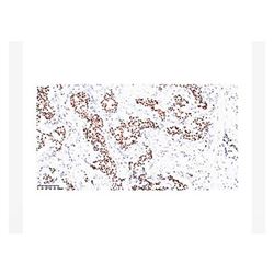 ZA-0554中杉金桥 AR(AndrogenReceptor)雄激素受体