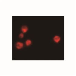 1020-03SouthernBiotech 山羊抗鼠IgM，人ads-TRITC